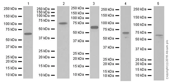 Western blot - Anti-Chk2 antibody [EPR19482] (AB207446)
