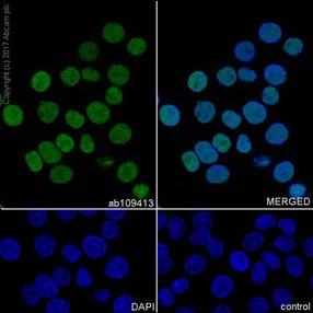 Immunocytochemistry/ Immunofluorescence - Anti-Chk2 antibody [EPR4325] (AB109413)