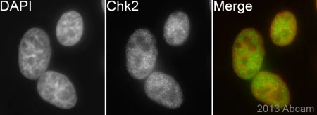 Immunocytochemistry/ Immunofluorescence - Anti-Chk2 antibody [EPR4325] (AB109413)