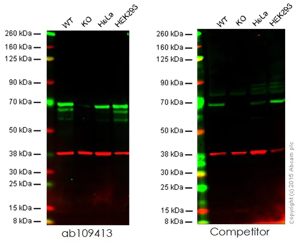 Western blot - Anti-Chk2 antibody [EPR4325] (AB109413)