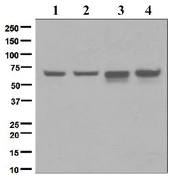 Western blot - Anti-Chk2 antibody [EPR4325] (AB109413)