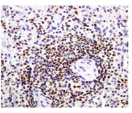 Immunohistochemistry (Formalin/PFA-fixed paraffin-embedded sections) - Anti-Chk2 antibody [EPR4325] - BSA and Azide free (AB227998)