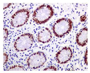Immunohistochemistry (Formalin/PFA-fixed paraffin-embedded sections) - Anti-Chk2 antibody [EPR4325] - BSA and Azide free (AB227998)