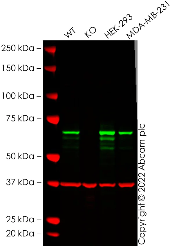 Western blot - Anti-Chk2 antibody [EPR4325] - BSA and Azide free (AB227998)