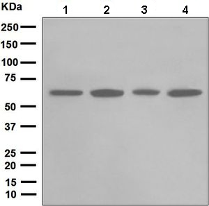 Western blot - Anti-Chk2 antibody [EPR5528] (AB133505), expandable thumbnail