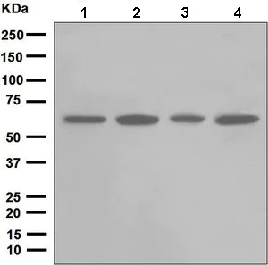 Western blot - Anti-Chk2 antibody [EPR5528] (AB133505)
