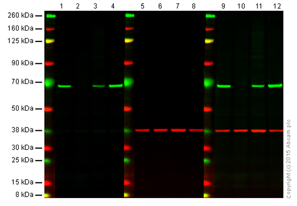 Western blot - Anti-Chk2 antibody [EPR5528] (AB133505), expandable thumbnail