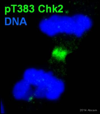 Immunocytochemistry - Anti-Chk2 (phospho T383) antibody (AB59408)