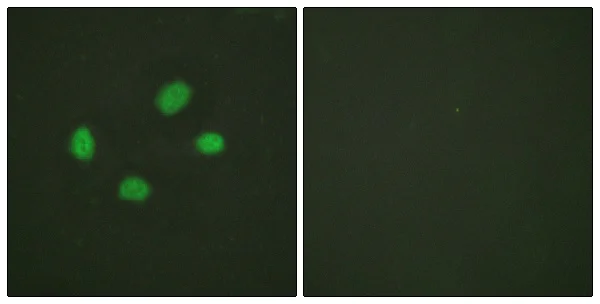 Immunocytochemistry - Anti-Chk2 (phospho T383) antibody (AB59408)
