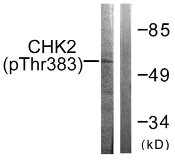 Western blot - Anti-Chk2 (phospho T383) antibody (AB59408)