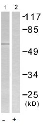 Western blot - Anti-Chk2 (phospho T387) antibody (AB55319)