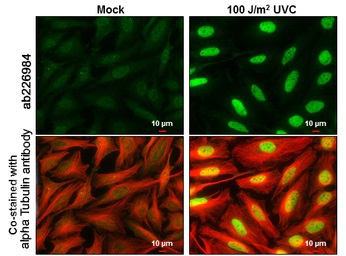Immunocytochemistry/ Immunofluorescence - Anti-Chk2 (phospho T68) antibody (AB226984)