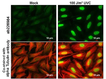 Immunocytochemistry/ Immunofluorescence - Anti-Chk2 (phospho T68) antibody (AB226984)