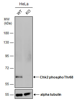 Western blot - Anti-Chk2 (phospho T68) antibody (AB226984), expandable thumbnail