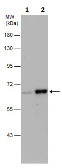 Western blot - Anti-Chk2 (phospho T68) antibody (AB226984), expandable thumbnail