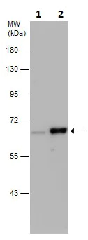 Western blot - Anti-Chk2 (phospho T68) antibody (AB226984)