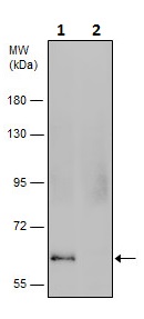 Western blot - Anti-Chk2 (phospho T68) antibody (AB226984), expandable thumbnail