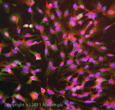 Immunocytochemistry/ Immunofluorescence - Anti-Chk2 (phospho T68) antibody (AB85743)