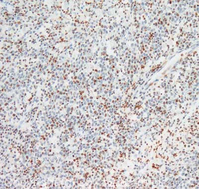 Immunohistochemistry (Formalin/PFA-fixed paraffin-embedded sections) - Anti-Chk2 (phospho T68) antibody (AB85743)