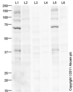 Anti-Chk2 (phospho T68) antibody (ab85743) | Abcam