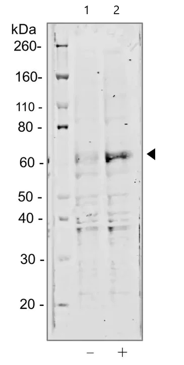 Western blot - Anti-Chk2 (phospho T68) antibody [Chk2T68-D12] (AB278548)