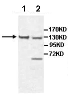 Western blot - Anti-CHL1 antibody (AB106269)