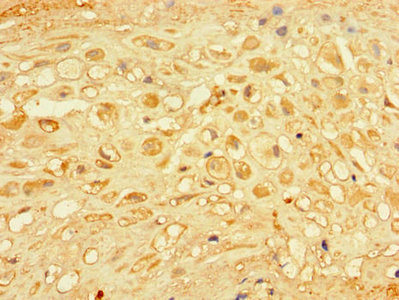 Immunohistochemistry (Formalin/PFA-fixed paraffin-embedded sections) - Anti-CHM antibody (AB236722)