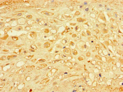 Immunohistochemistry (Formalin/PFA-fixed paraffin-embedded sections) - Anti-CHM antibody (AB236722)