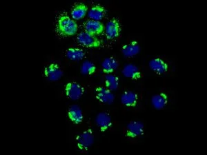Immunocytochemistry/ Immunofluorescence - Anti-CHM antibody [EPR7142] (AB134964)
