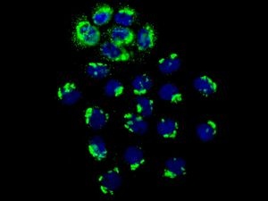 Immunocytochemistry/ Immunofluorescence - Anti-CHM antibody [EPR7142] - BSA and Azide free (AB248756), expandable thumbnail
