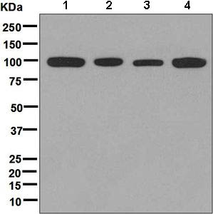 Western blot - Anti-CHM antibody [EPR7142] - BSA and Azide free (AB248756), expandable thumbnail