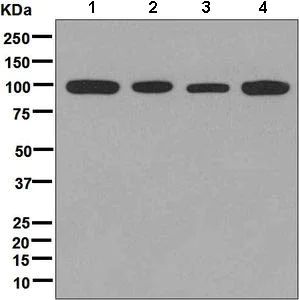 Western blot - Anti-CHM antibody [EPR7142] - BSA and Azide free (AB248756)