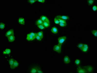 Immunocytochemistry/ Immunofluorescence - Anti-CHMP1a antibody (AB237676)