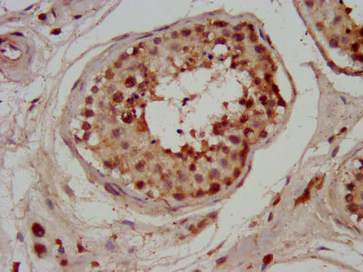 Immunohistochemistry (Formalin/PFA-fixed paraffin-embedded sections) - Anti-CHMP1a antibody (AB237676)