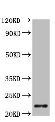 Western blot - Anti-CHMP1a antibody (AB237676)