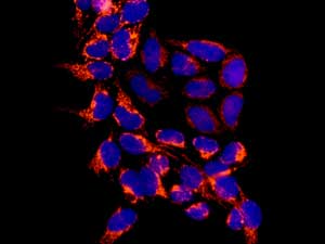 Immunocytochemistry/ Immunofluorescence - Anti-CHMP1a antibody [EPR11938(B)] (AB167412)