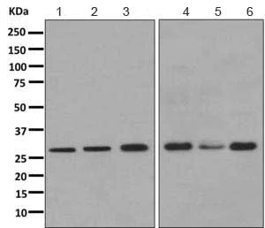 Western blot - Anti-CHMP1a antibody [EPR11938(B)] (AB167412)