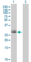 Western blot - Anti-CHMP2A/BC2 antibody (AB67064)