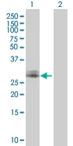 Western blot - Anti-CHMP2A/BC2 antibody (AB67064)
