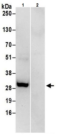 Immunoprecipitation - Anti-CHMP2B antibody (AB226298)