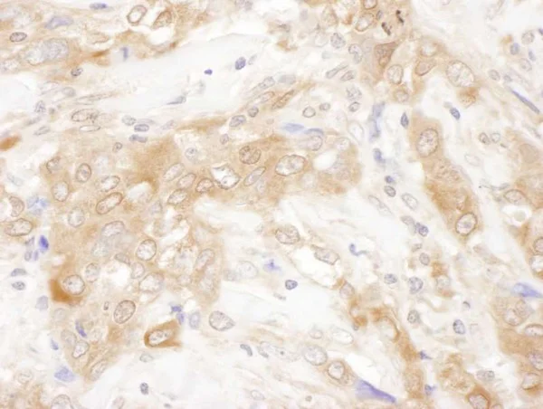 Immunohistochemistry (Formalin/PFA-fixed paraffin-embedded sections) - Anti-CHMP2B antibody (AB226304)