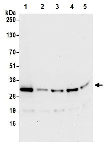 Western blot - Anti-CHMP2B antibody (AB226304)