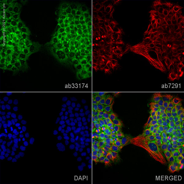 Immunocytochemistry/ Immunofluorescence - Anti-CHMP2B antibody (AB33174)