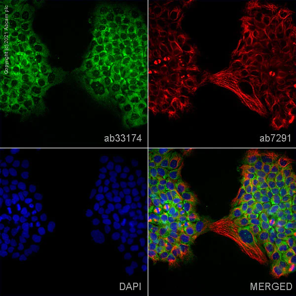Immunocytochemistry/ Immunofluorescence - Anti-CHMP2B antibody (AB33174)