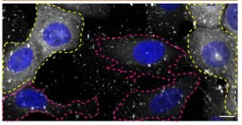 Immunocytochemistry/ Immunofluorescence - Anti-CHMP2B antibody [EPR10807(B)] (AB157208)