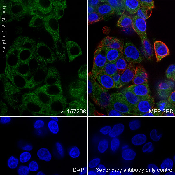 Immunocytochemistry/ Immunofluorescence - Anti-CHMP2B antibody [EPR10807(B)] - BSA and Azide free (AB249311), expandable thumbnail