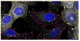 Immunocytochemistry/ Immunofluorescence - Anti-CHMP2B antibody [EPR10807(B)] - BSA and Azide free (ab249311), expandable thumbnail