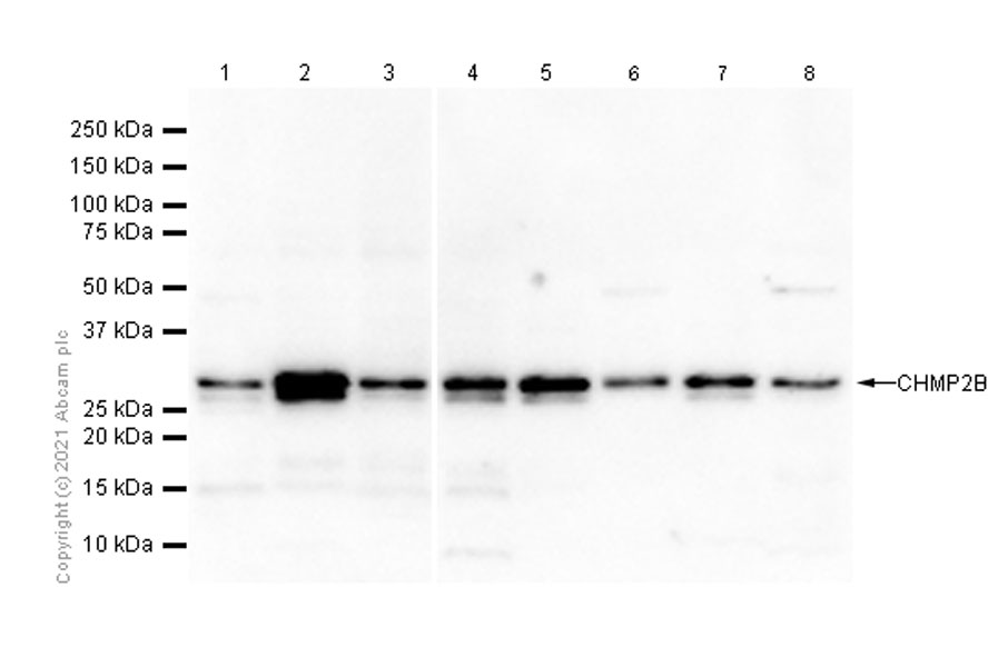 Western blot - Anti-CHMP2B antibody [EPR10807(B)] - BSA and Azide free (AB249311), expandable thumbnail