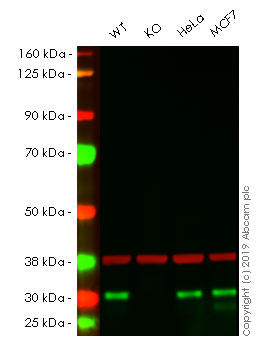 Western blot - Anti-CHMP2B antibody [EPR10807(B)] - BSA and Azide free (AB249311), expandable thumbnail