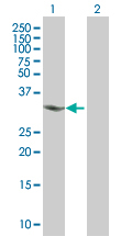 Western blot - Anti-CHMP4A antibody (AB67058)
